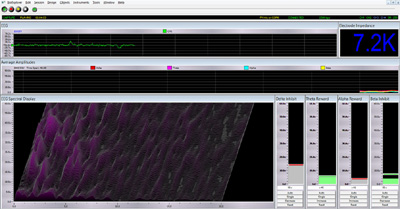 BioExplorer U-wiz Neurofeedback Alpha/Theta