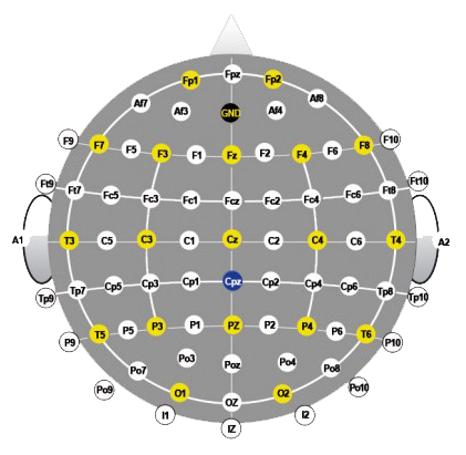 Elektrodenbelegung nach 10/20-Schema 