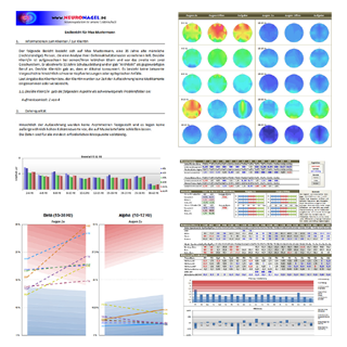 QEEG-Gehirnaktivitätsmusteranalyse