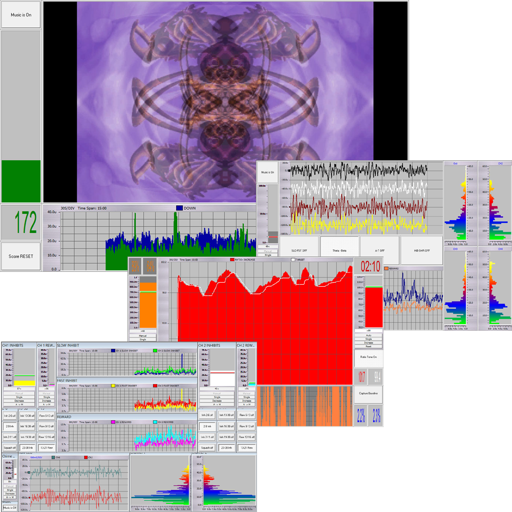 Bild von Trainings-Designs Paket für BioExplorer